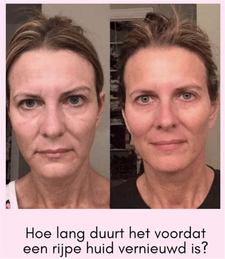 Hoe Lang Duurt Het Voordat Chocolade Hard Wordt? (Solved)