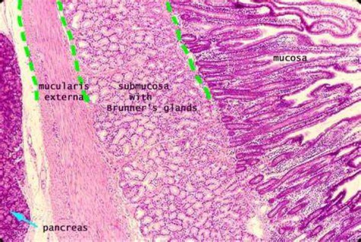 How do you identify a histology duodenum?