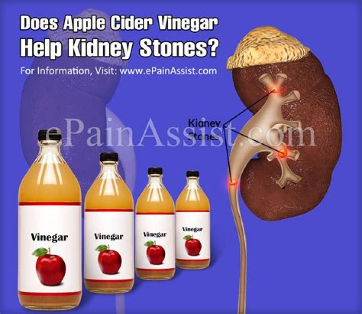 How does apple cider vinegar cure kidney infections?