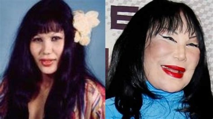 Lyn May: What Happened To Her Face?