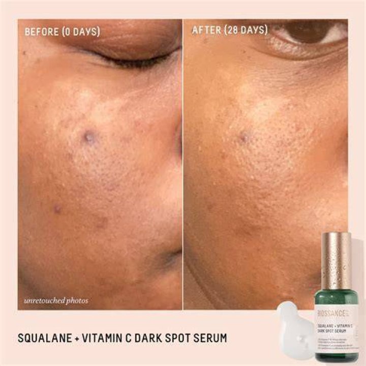 Squalane and Vitamin C Dark Spot Serum Squalane and Vitamin C Dark Spot Serum