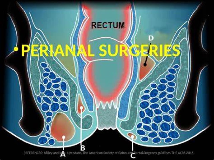 What Area Is The Peri-anal Buttocks? (Solution)