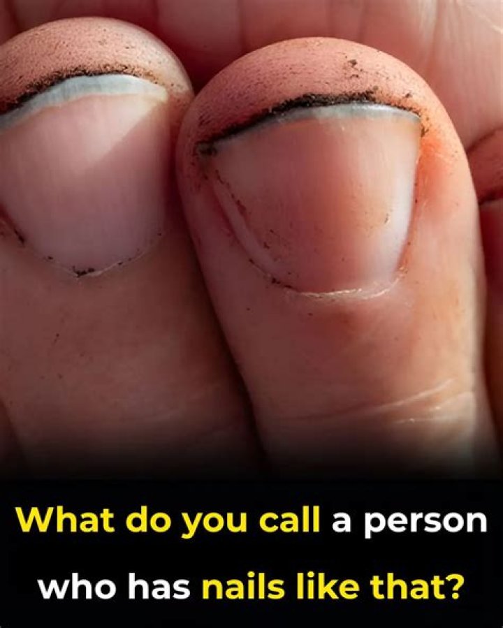 What do you call a person who does nails?