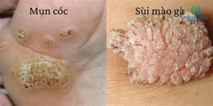 What is a Sui COC?