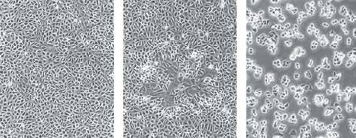 What is meant by cytopathic effect?