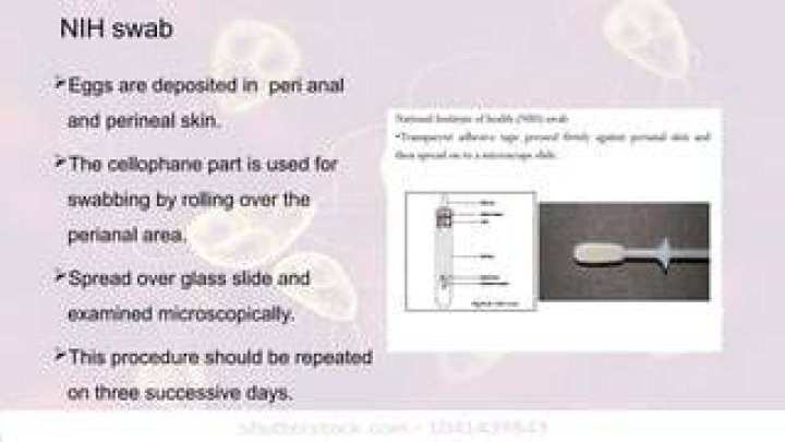 What Is Peri-anal Swabbing? (Solved)