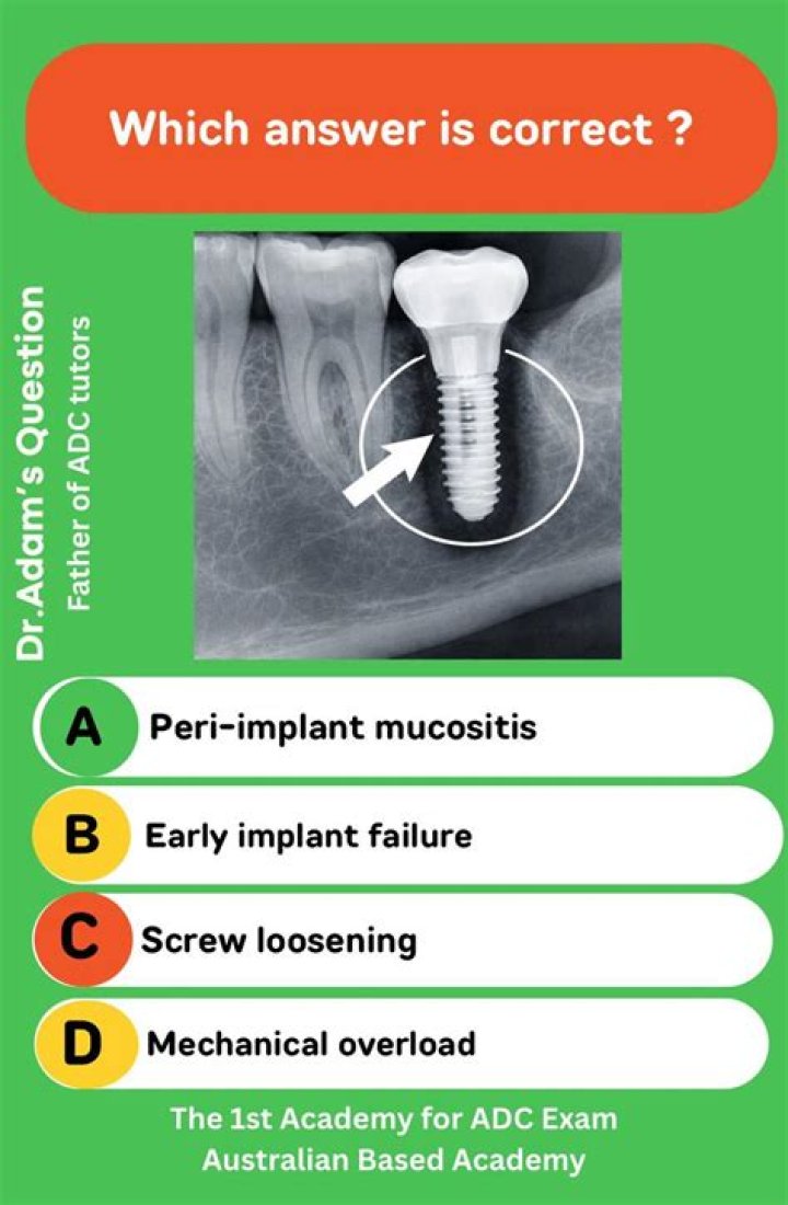 What Is Peri Dental? (Question)