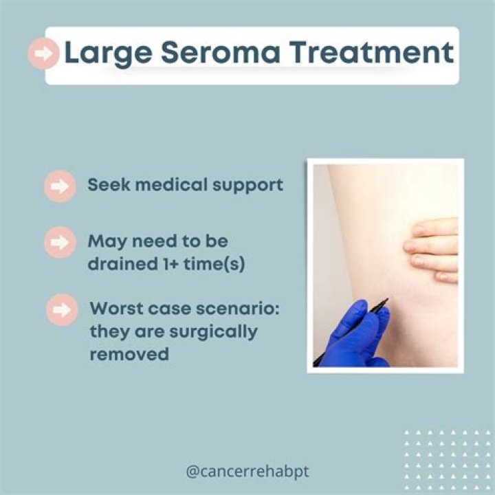 What Is Peri-implant Seroma? (Solution found)