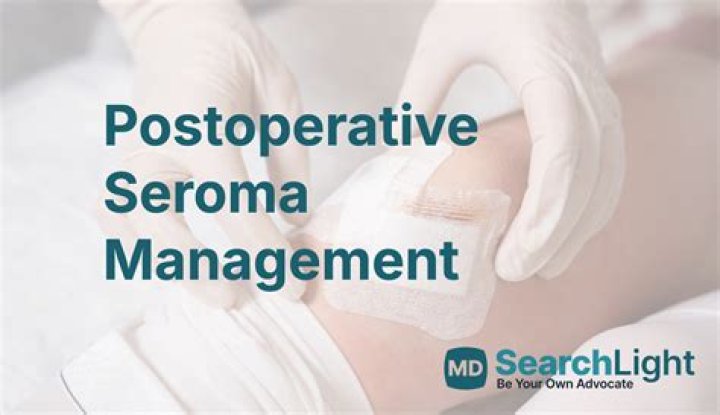 What Is Peri Implant Seroma?