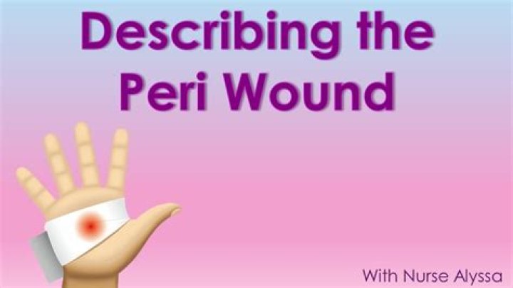 What Is Peri-wound? (Question)