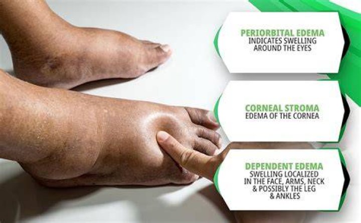 What is swelling solution?