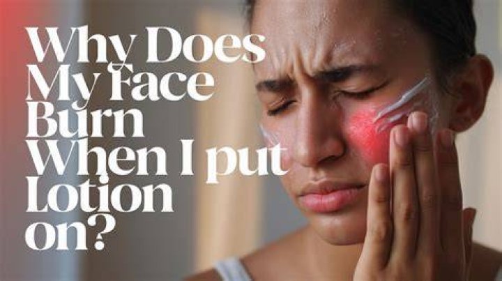 Why Does Hot Sauce Burn Irrated Skin? (Question)