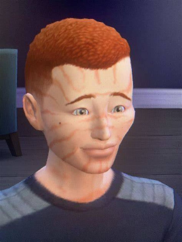 Why is my Sim covered in tiger stripes?